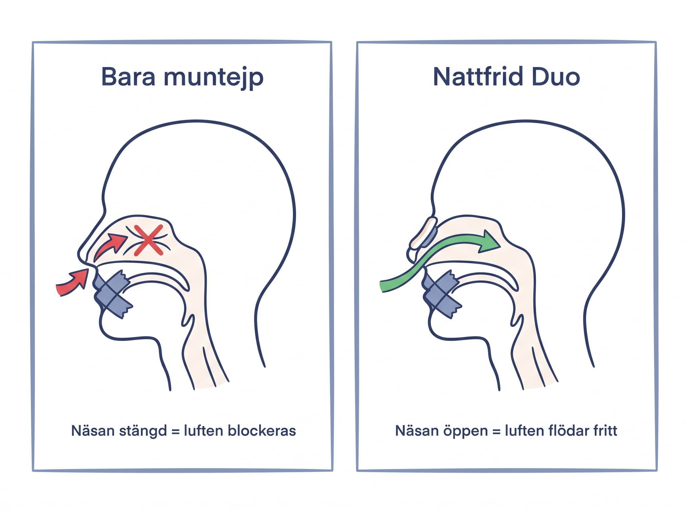 Infografik: Bara muntejp vs Nattfrid Duo – blockerat vs fritt luftflöde genom näsan
