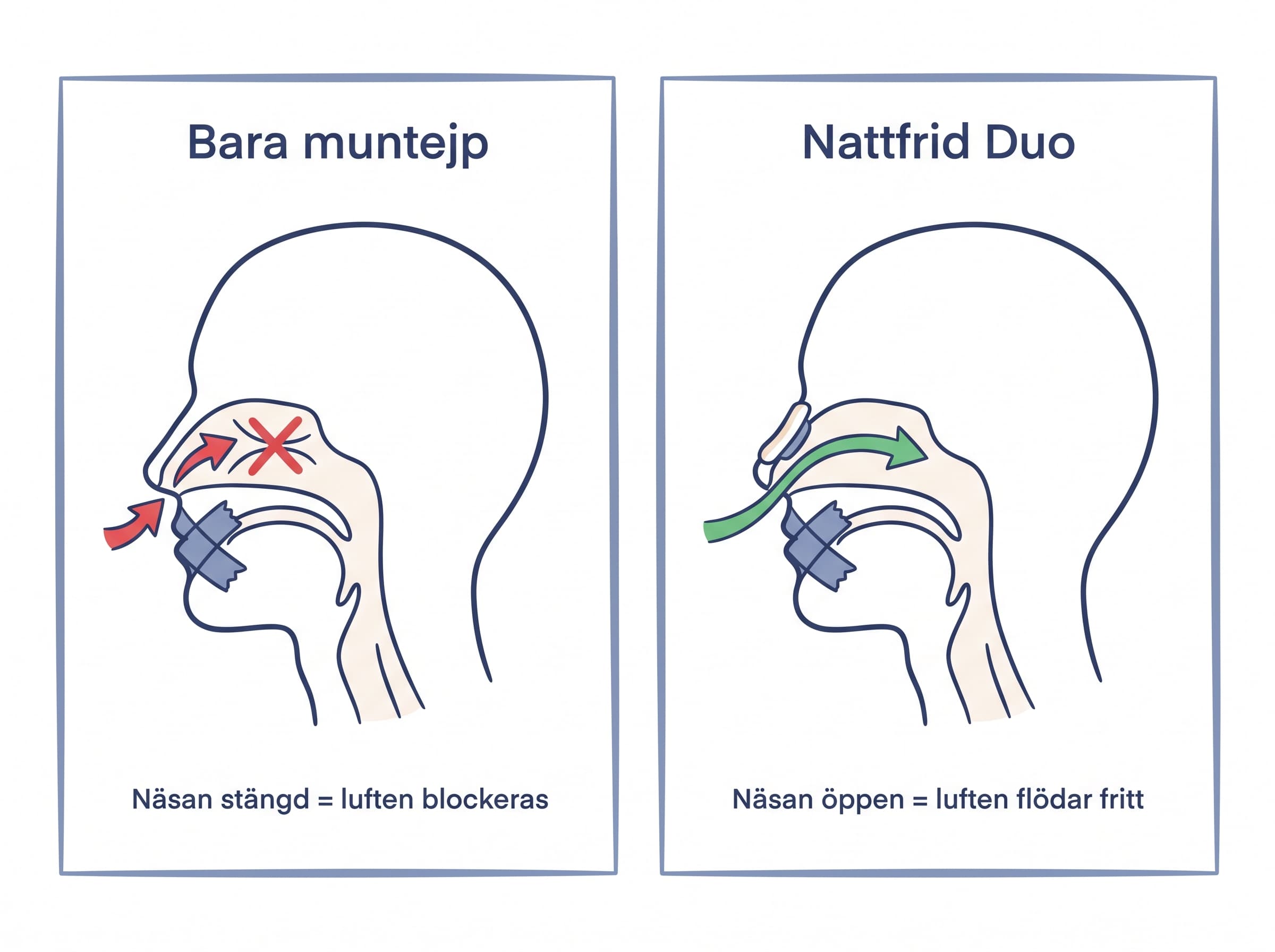 Infografik: Bara muntejp vs Nattfrid Duo – blockerat vs fritt luftflöde genom näsan